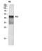 Cyclin Dependent Kinase Inhibitor 1C antibody, STJ94911, St John