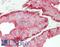 Keratin 5 antibody, LS-B12241, Lifespan Biosciences, Immunohistochemistry paraffin image 