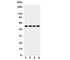 Cystatin A antibody, R31217, NSJ Bioreagents, Western Blot image 