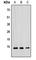 RAD52 Motif Containing 1 antibody, abx121697, Abbexa, Western Blot image 