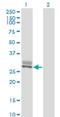 Serine Peptidase Inhibitor, Kunitz Type 2 antibody, H00010653-M01, Novus Biologicals, Western Blot image 