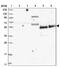 Zinc Finger Protein 543 antibody, NBP1-85122, Novus Biologicals, Western Blot image 