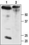 Potassium Calcium-Activated Channel Subfamily M Regulatory Beta Subunit 4 antibody, PA5-77611, Invitrogen Antibodies, Western Blot image 