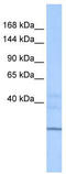 Zinc Finger HIT-Type Containing 1 antibody, TA339701, Origene, Western Blot image 