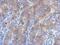 Inhibitor Of Nuclear Factor Kappa B Kinase Subunit Beta antibody, NBP1-32258, Novus Biologicals, Immunohistochemistry paraffin image 