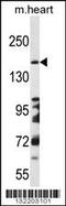 DCC Netrin 1 Receptor antibody, 56-355, ProSci, Western Blot image 