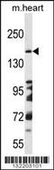DCC Netrin 1 Receptor antibody, 56-355, ProSci, Western Blot image 