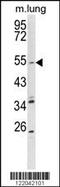 Potassium voltage-gated channel subfamily KQT member 1 antibody, 63-714, ProSci, Western Blot image 