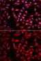 Carbonyl Reductase 1 antibody, GTX53925, GeneTex, Immunofluorescence image 