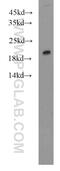 Fibronectin Type III Domain Containing 5 antibody, 23995-1-AP, Proteintech Group, Western Blot image 