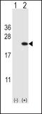 Cofilin 1 antibody, PA5-24628, Invitrogen Antibodies, Western Blot image 