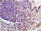 Lon Peptidase 1, Mitochondrial antibody, GTX51596, GeneTex, Immunohistochemistry paraffin image 