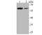 P21 (RAC1) Activated Kinase 2 antibody, A01419-3, Boster Biological Technology, Western Blot image 