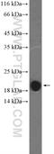 Troponin C1, Slow Skeletal And Cardiac Type antibody, 13504-1-AP, Proteintech Group, Western Blot image 