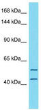 Tetratricopeptide repeat protein 7A antibody, TA346808, Origene, Western Blot image 