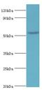 BTG3 Associated Nuclear Protein antibody, LS-C379060, Lifespan Biosciences, Western Blot image 