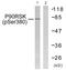 Ribosomal Protein S6 Kinase A1 antibody, LS-C199394, Lifespan Biosciences, Western Blot image 