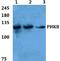Phosphorylase Kinase Regulatory Subunit Beta antibody, A07418, Boster Biological Technology, Western Blot image 