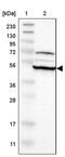 Ring Finger Protein 130 antibody, PA5-53181, Invitrogen Antibodies, Western Blot image 