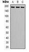 DNA Topoisomerase II Alpha antibody, orb318872, Biorbyt, Western Blot image 