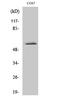 Zinc Finger C3HC-Type Containing 1 antibody, A07135, Boster Biological Technology, Western Blot image 