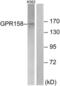 G Protein-Coupled Receptor 158 antibody, LS-C120698, Lifespan Biosciences, Western Blot image 