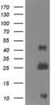 Aldehyde Dehydrogenase 1 Family Member A3 antibody, NBP2-46510, Novus Biologicals, Western Blot image 