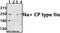 Sodium Voltage-Gated Channel Alpha Subunit 2 antibody, GTX66721, GeneTex, Western Blot image 