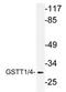 Glutathione S-Transferase Theta 1 antibody, AP21182PU-N, Origene, Western Blot image 