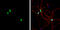 Cytoplasmic Polyadenylation Element Binding Protein 1 antibody, GTX104682, GeneTex, Immunocytochemistry image 