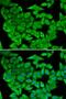 Malate Dehydrogenase 2 antibody, LS-C748564, Lifespan Biosciences, Immunofluorescence image 
