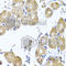 Ras Homolog Family Member B antibody, A2819, ABclonal Technology, Immunohistochemistry paraffin image 