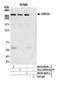 Ubiquitin Specific Peptidase 24 antibody, NB100-40830, Novus Biologicals, Western Blot image 