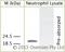 Cathelicidin Antimicrobial Peptide antibody, LS-C94015, Lifespan Biosciences, Western Blot image 