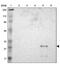 Ankyrin Repeat And SOCS Box Containing 6 antibody, PA5-52077, Invitrogen Antibodies, Western Blot image 