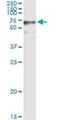 Glutamine-Fructose-6-Phosphate Transaminase 2 antibody, H00009945-D01P, Novus Biologicals, Western Blot image 