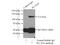 Electrogenic sodium bicarbonate cotransporter 1 antibody, 11885-1-AP, Proteintech Group, Immunoprecipitation image 