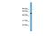 Actin Related Protein 10 antibody, PA5-44739, Invitrogen Antibodies, Western Blot image 