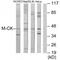 Creatine Kinase, M-Type antibody, MBS9401572, MyBioSource, Western Blot image 