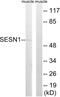 Sestrin 1 antibody, abx014876, Abbexa, Western Blot image 