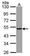 Hydroxyacyl-CoA Dehydrogenase Trifunctional Multienzyme Complex Subunit Beta antibody, TA308352, Origene, Western Blot image 