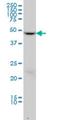 Dynactin Subunit 2 antibody, H00010540-M01, Novus Biologicals, Western Blot image 