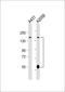 ADAM Metallopeptidase With Thrombospondin Type 1 Motif 17 antibody, LS-C392638, Lifespan Biosciences, Western Blot image 