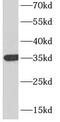 CD7 Molecule antibody, FNab01496, FineTest, Western Blot image 
