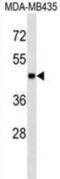 Erk1 antibody, abx025312, Abbexa, Western Blot image 