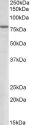 SET Domain Bifurcated Histone Lysine Methyltransferase 2 antibody, 46-361, ProSci, Enzyme Linked Immunosorbent Assay image 