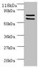 Succinate dehydrogenase [ubiquinone] flavoprotein subunit, mitochondrial antibody, orb242325, Biorbyt, Western Blot image 