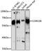 Coronin 2B antibody, 16-705, ProSci, Western Blot image 