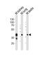 Epithelial Cell Adhesion Molecule antibody, A00276, Boster Biological Technology, Western Blot image 