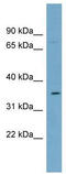 Solute Carrier Family 39 Member 2 antibody, TA333868, Origene, Western Blot image 
